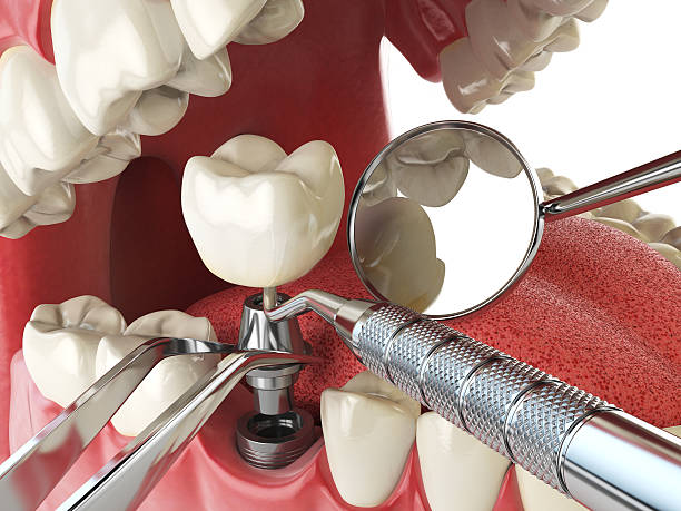 Best Emergency Dental Care for Broken or Chipped Teeth in Magnolia, MS